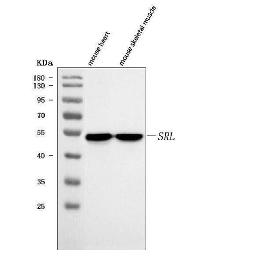 Anti-Sarcalumenin/Srl Antibody Picoband® Boster Bio