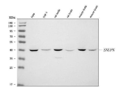 Anti-SNURPORTIN1/SNUPN Antibody Picoband® Boster Bio