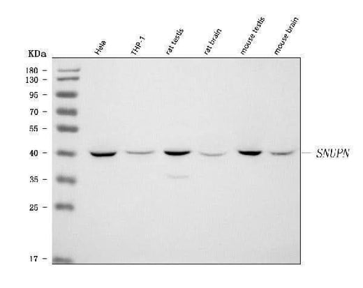 Anti-SNURPORTIN1/SNUPN Antibody Picoband® Boster Bio
