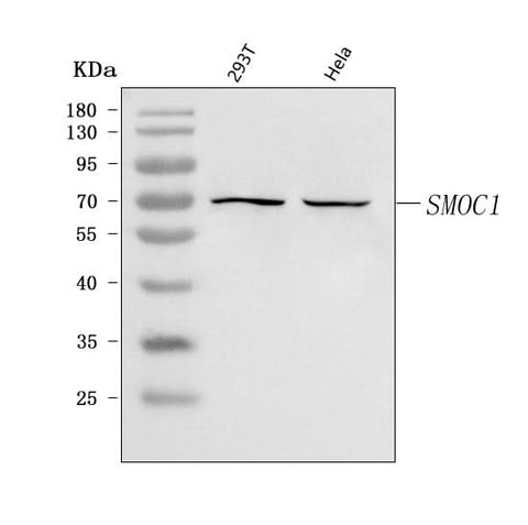 Anti-SMOC1 Antibody Picoband® Boster Bio