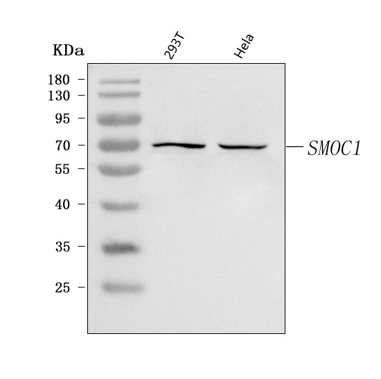 Anti-SMOC1 Antibody Picoband® Boster Bio
