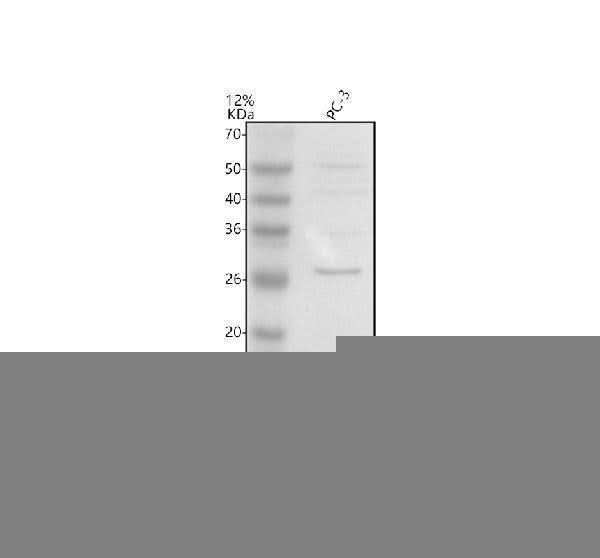 Anti-UBE2W Antibody Picoband® Boster Bio
