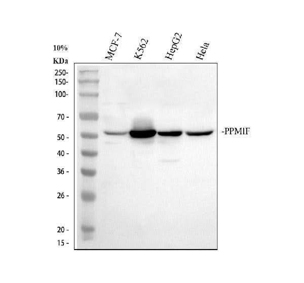 Anti-PPM1F Antibody Picoband® Boster Bio