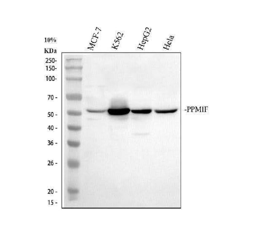 Anti-PPM1F Antibody Picoband® Boster Bio