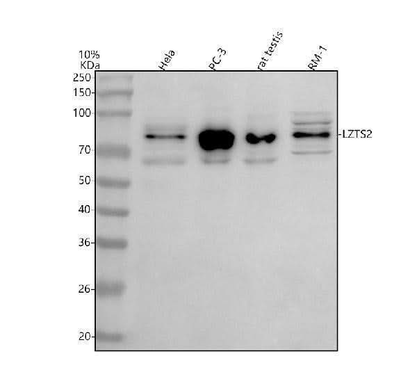 Anti-LZTS2 Antibody Picoband® Boster Bio