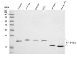 Anti-RIT2 Antibody Picoband® Boster Bio
