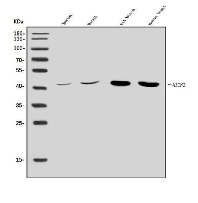 Anti-Arginine decarboxylase/AZIN2 Antibody Picoband® Boster Bio