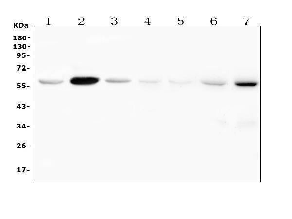 Anti-Fascin 2/FSCN2 Antibody Picoband® Boster Bio