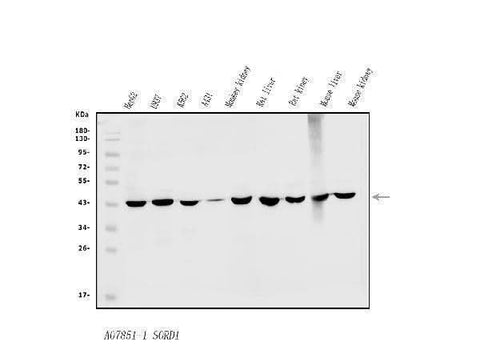 Anti-Sorbitol Dehydrogenase/SORD Antibody Picoband® Boster Bio