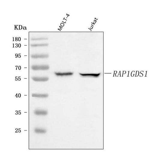 Anti-RAP1GDS1 Antibody Picoband® Boster Bio