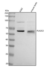 Anti-PLA2G3 Antibody Picoband® Boster Bio
