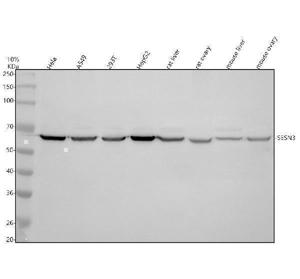 Anti-SESN3 Antibody Picoband® Boster Bio