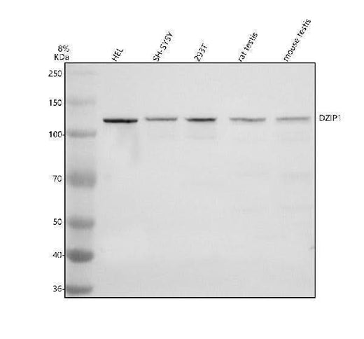 Anti-TTLL8 Antibody Picoband® Boster Bio