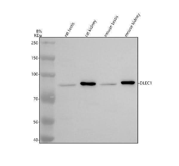 Anti-DLEC1 Antibody Picoband® Boster Bio