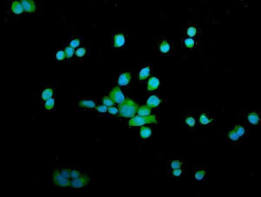 Anti-OTULIN Antibody Picoband® Boster Bio