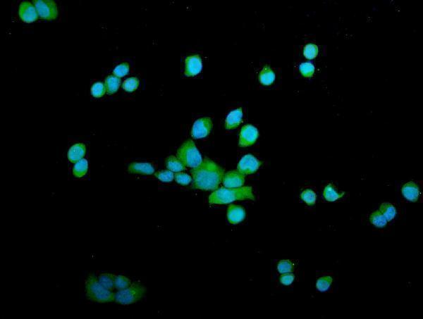 Anti-OTULIN Antibody Picoband® Boster Bio