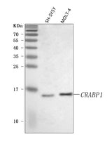 Anti-CRABP1 Antibody Picoband® Boster Bio