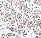 Anti-PRMT8 Antibody Picoband® Boster Bio