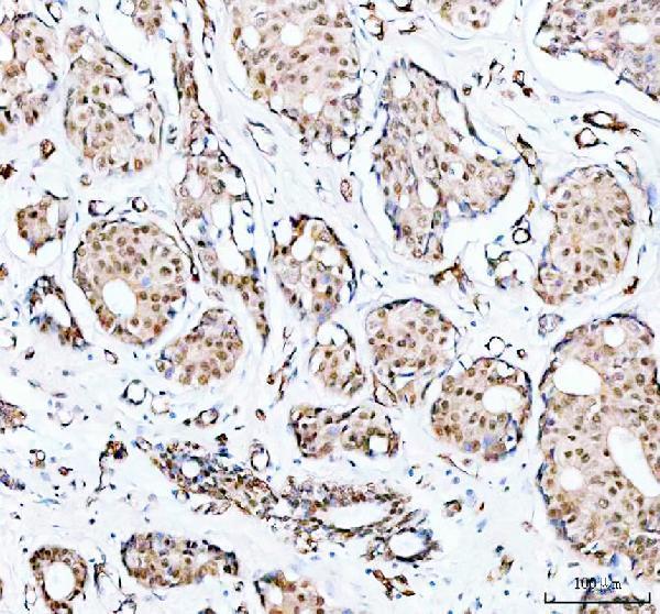 Anti-PRMT8 Antibody Picoband® Boster Bio