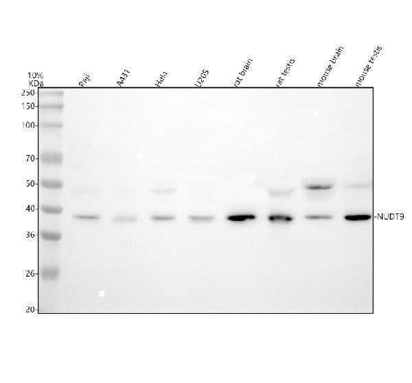Anti-NUDT9 Antibody Picoband® Boster Bio