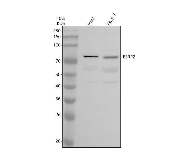 Anti-EIF2S3 Antibody Picoband® Boster Bio
