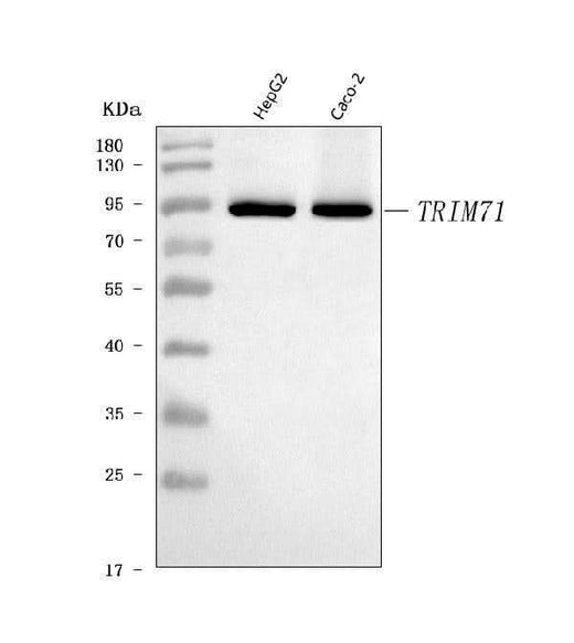 Anti-LIN41/TRIM71 Antibody Picoband® Boster Bio