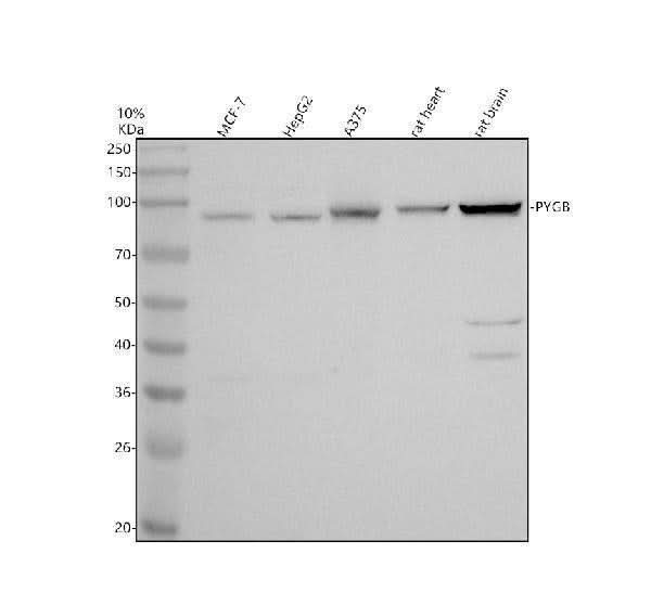 Anti-PYGB Antibody Picoband® Boster Bio