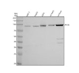 Anti-PYGB Antibody Picoband® Boster Bio
