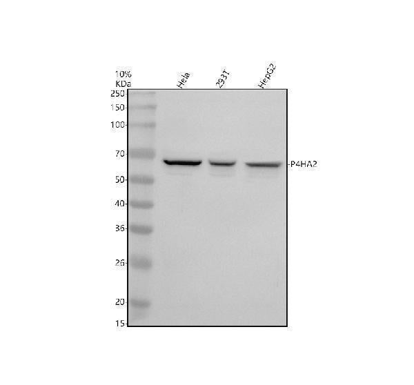Anti-P4HA2 Antibody Picoband® Boster Bio