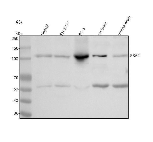 Anti-GBA2 Antibody Picoband® Boster Bio