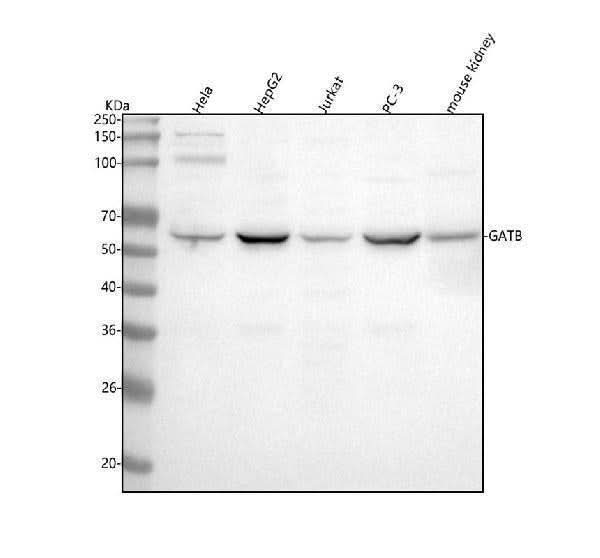 Anti-GATB Antibody Picoband® Boster Bio