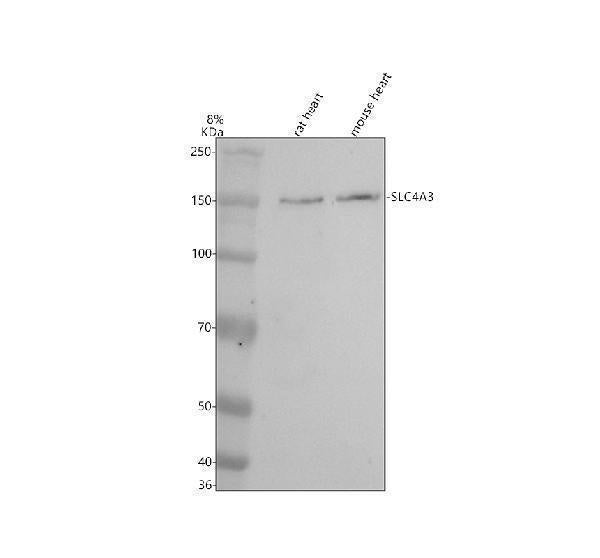 Anti-SLC4A3 Antibody Picoband® Boster Bio