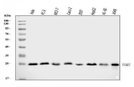 Anti-Proteasome 20S beta 7/PSMB7 Antibody Picoband® Boster Bio