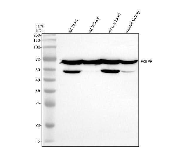 Anti-FKBP9 Antibody Picoband® Boster Bio