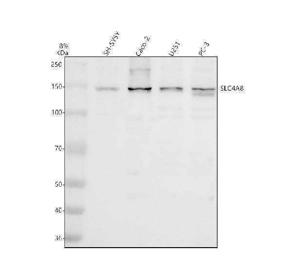 Anti-SLC4A8 Antibody Picoband® Boster Bio