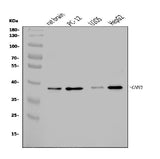 Anti-Calponin 3/CNN3 Antibody Picoband® Boster Bio