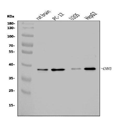 Anti-Calponin 3/CNN3 Antibody Picoband® Boster Bio