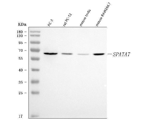 Anti-SPATA7 Antibody Picoband® Boster Bio