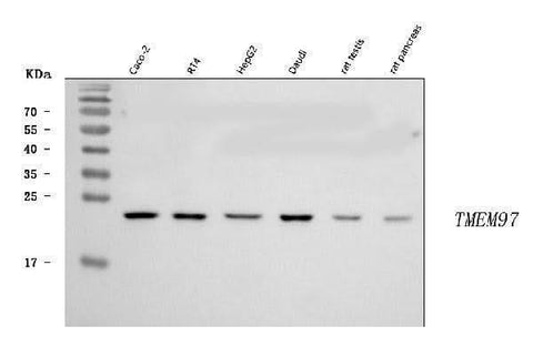 Anti-TMEM97 Antibody Picoband® Boster Bio