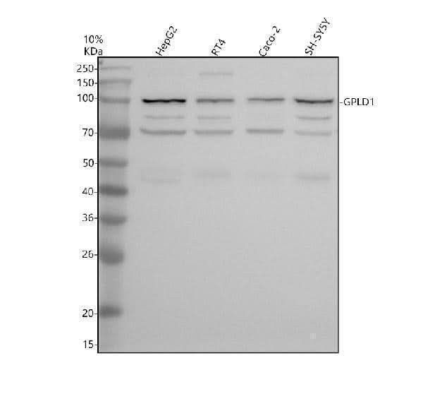 Anti-GPLD1 Antibody Picoband® Boster Bio