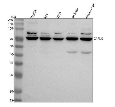 Anti-CAPN5 Antibody Picoband® Boster Bio