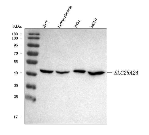 Anti-SLC25A24 Antibody Picoband® Boster Bio