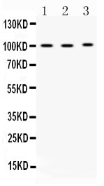 Anti-ADAM2 Antibody Picoband® Boster Bio