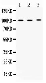 Anti-ADAM2 Antibody Picoband® Boster Bio