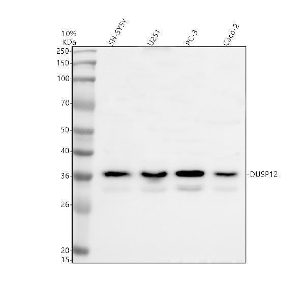 Anti-EIF3M Antibody Picoband® Boster Bio