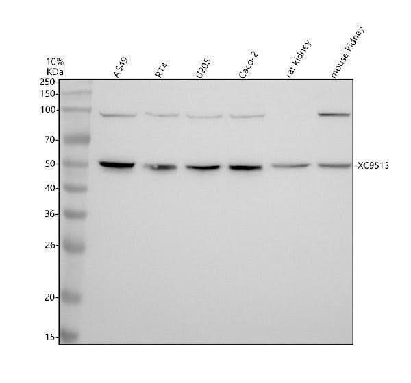 Anti-STEAP2 Antibody Picoband® Boster Bio