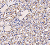 Anti-HECTD1 Antibody Picoband® Boster Bio