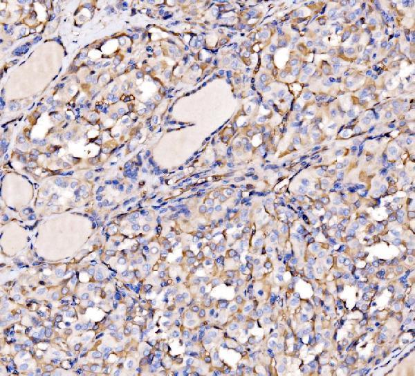 Anti-HECTD1 Antibody Picoband® Boster Bio