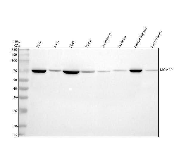 Anti-MCMBP Antibody Picoband® Boster Bio