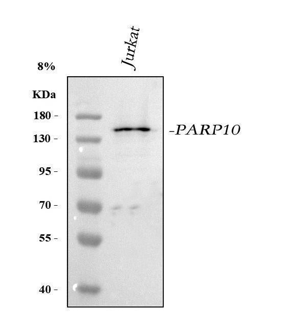 Anti-PARP10 Antibody Picoband® Boster Bio